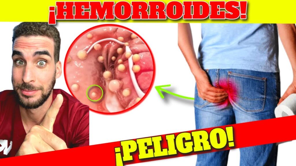 8 Alternativas efectivas a las pastillas sin receta para combatir la ansiedad 1 8 alternativas efectivas a las p