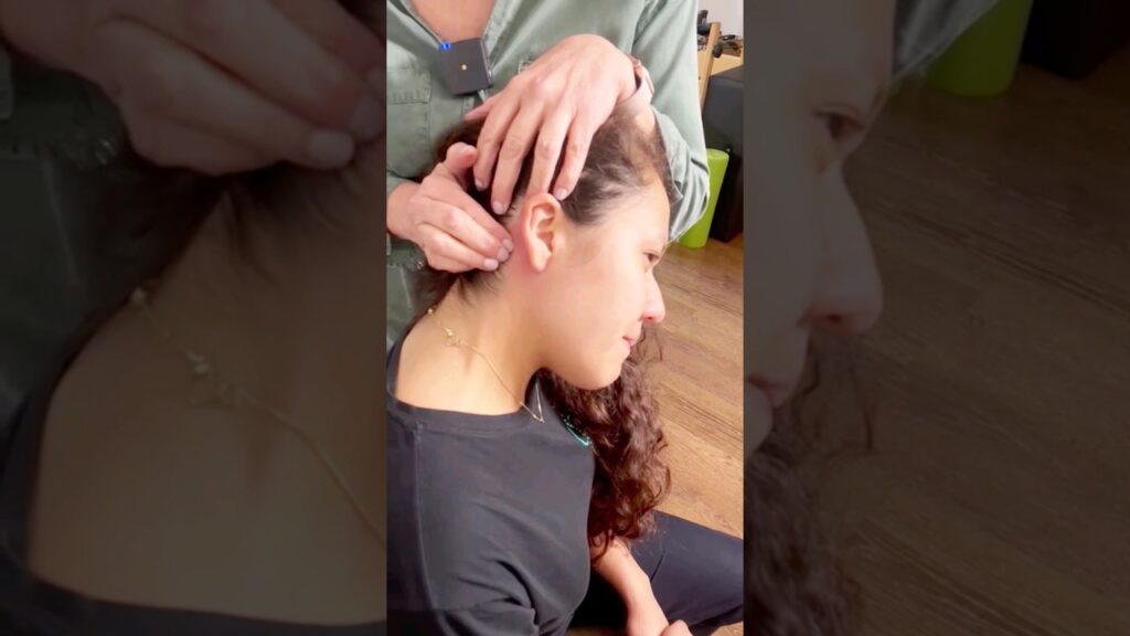 Acupuntura: una técnica infalible para aliviar el dolor de cabeza 1 acupuntura una tecnica infalible