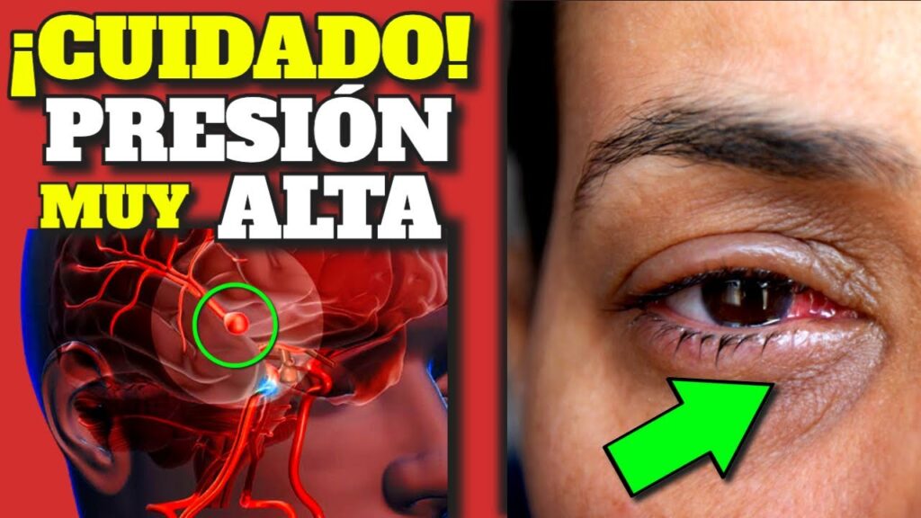 Ansiedad: ¿puede ser mortal para tu salud? Descubre las consecuencias graves que podría tener. 1 ansiedad puede ser mortal para t