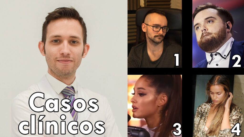 ¿Ansioso por la caída de cabello? Descubre cómo superar el miedo a la calvicie desde la psicología 1 ansioso por la caida de cabello