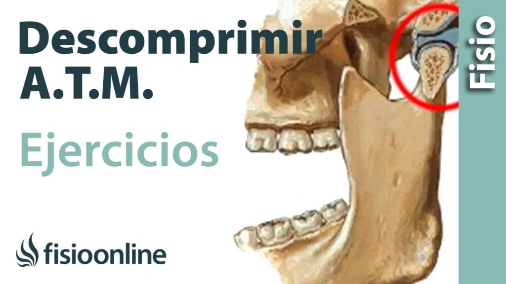 Bruxismo y dolores de cabeza: cómo la tensión mandibular puede afectar tu bienestar psicológico. 1 bruxismo y dolores de cabeza com