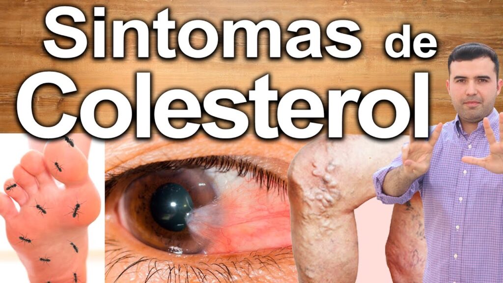 Cómo el estrés afecta tu colesterol: explicado desde la psicología 1 como el estres afecta tu coleste