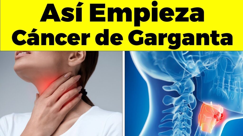 Cómo la ansiedad puede afectar tu salud física: el caso de la irritación de garganta 1 como la ansiedad puede afectar t 1