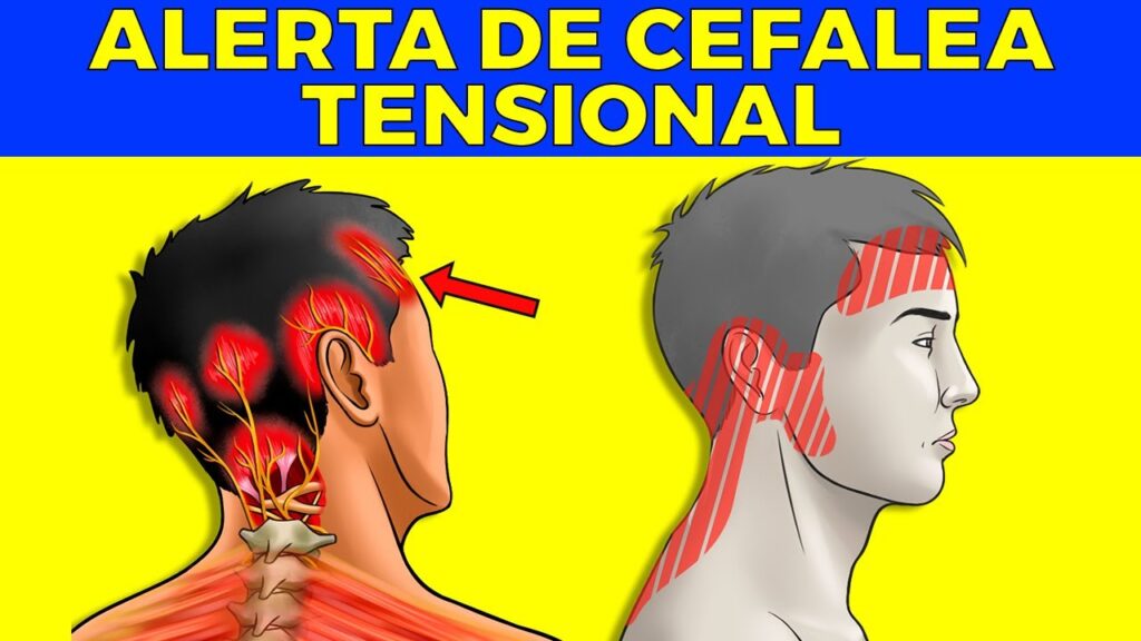 Cuando el placer se convierte en dolor: la conexión entre la eyaculación y las cefaleas desde una perspectiva psicológica 1 cuando el placer se convierte en 1