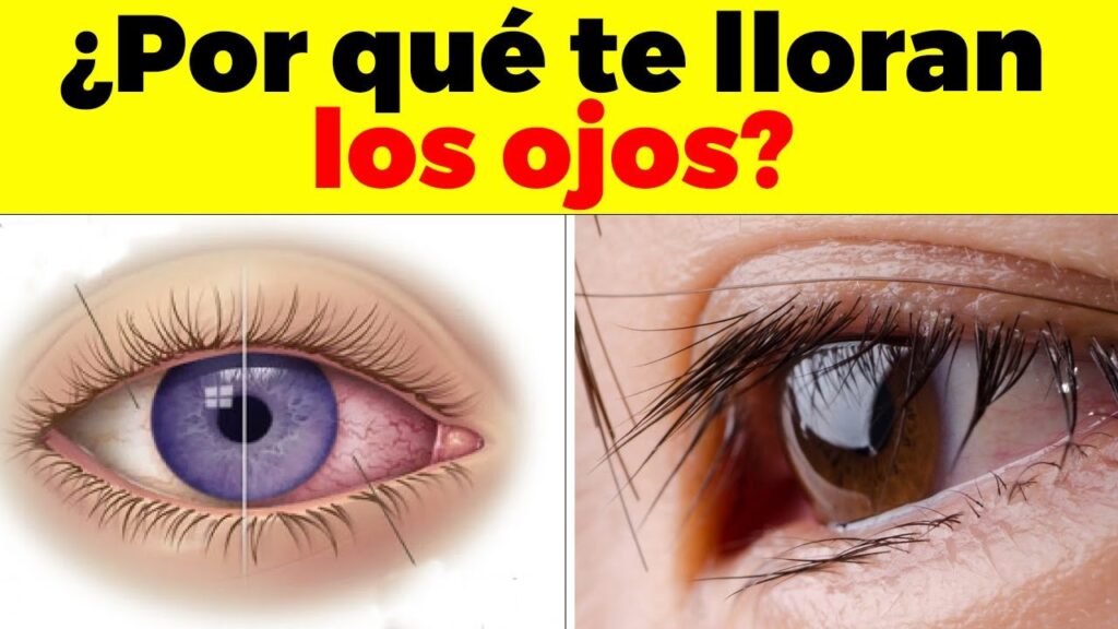 Descubriendo el porqué de las contracciones involuntarias de los párpados desde la psicología 1 descubriendo el porque de las co