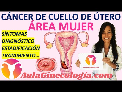 Detectar el cáncer de útero durante la menopausia: Síntomas a tener en cuenta y recomendaciones para una detección temprana 1 detectar el cancer de utero dura