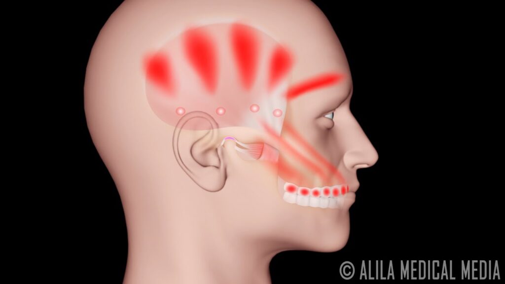 Dolor de cabeza en el lado izquierdo: ¿podría estar afectando tu salud visual? 1 dolor de cabeza en el lado izqui