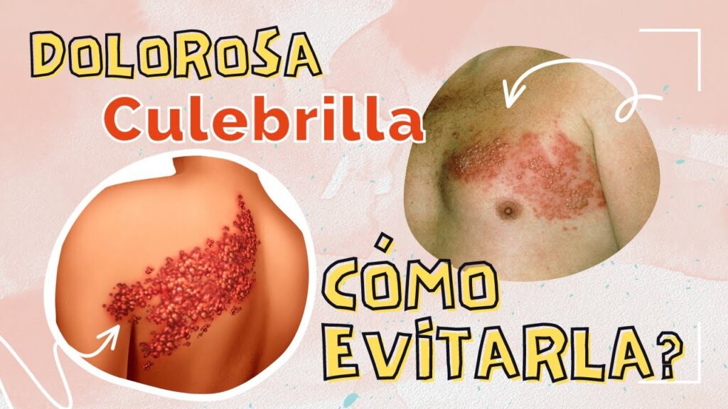 El dolor crónico del nervio trigémino tras el herpes zóster: abordaje psicológico 1 el dolor cronico del nervio trig