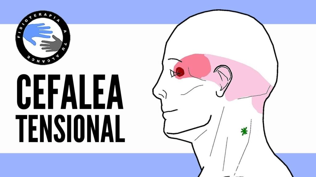 El dolor de cabeza bilateral: aspectos psicológicos, causas y soluciones 1 el dolor de cabeza bilateral asp