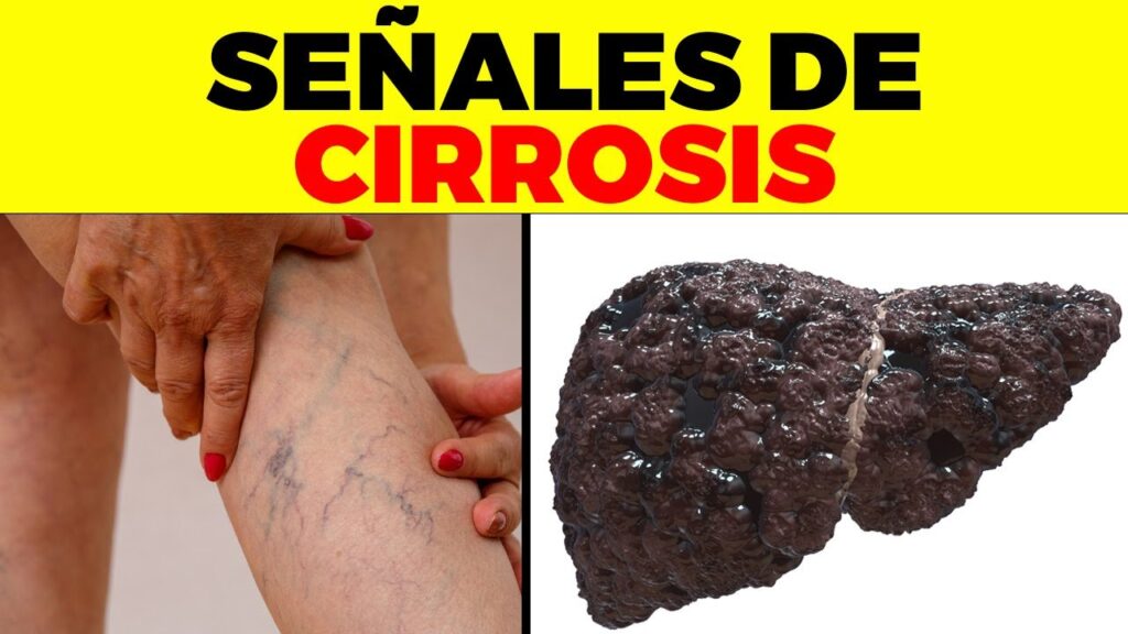 El dolor de cabeza por consumo de vino blanco: su impacto psicológico y cómo manejarlo 1 el dolor de cabeza por consumo d