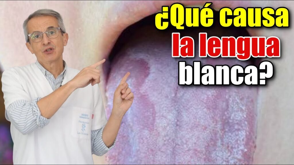 El enigma del dolor de cabeza y la lengua blanca: Revelaciones sobre nuestra salud mental 1 el enigma del dolor de cabeza y