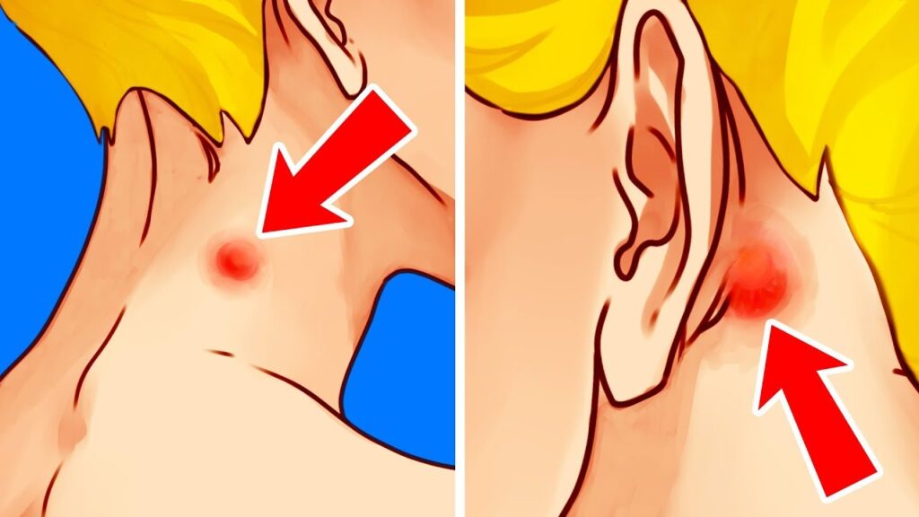El estrés y los bultos en el cuello: una mirada desde la psicología 1 el estres y los bultos en el cue 1