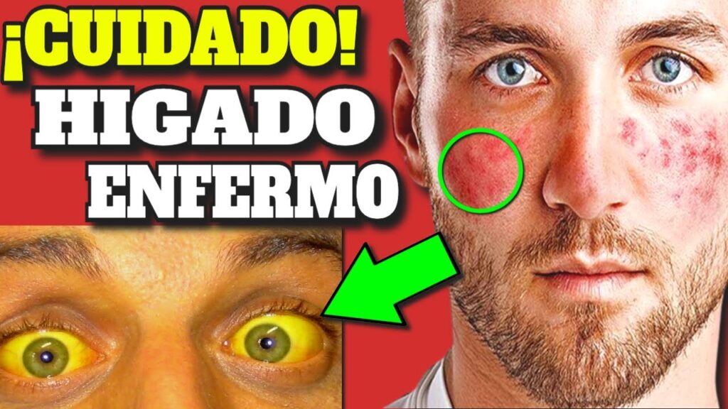 El estrés y su impacto en el cuerpo: El dolor de manos como síntoma psicológico 1 el estres y su impacto en el cue