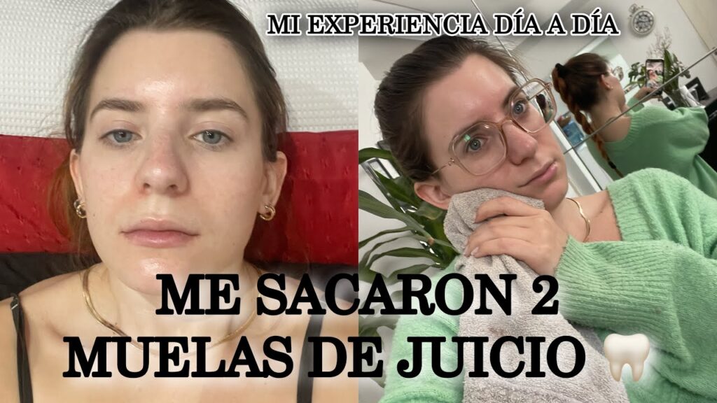 El impacto de las muelas del juicio en tu salud mental y emocional: todo lo que necesitas saber 1 el impacto de las muelas del jui