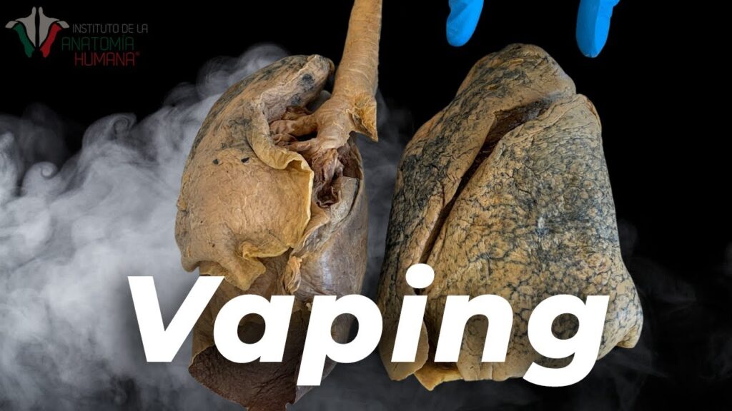 El impacto del consumo de nicotina en los trastornos de ansiedad desde la perspectiva psicológica 1 el impacto del consumo de nicoti 1