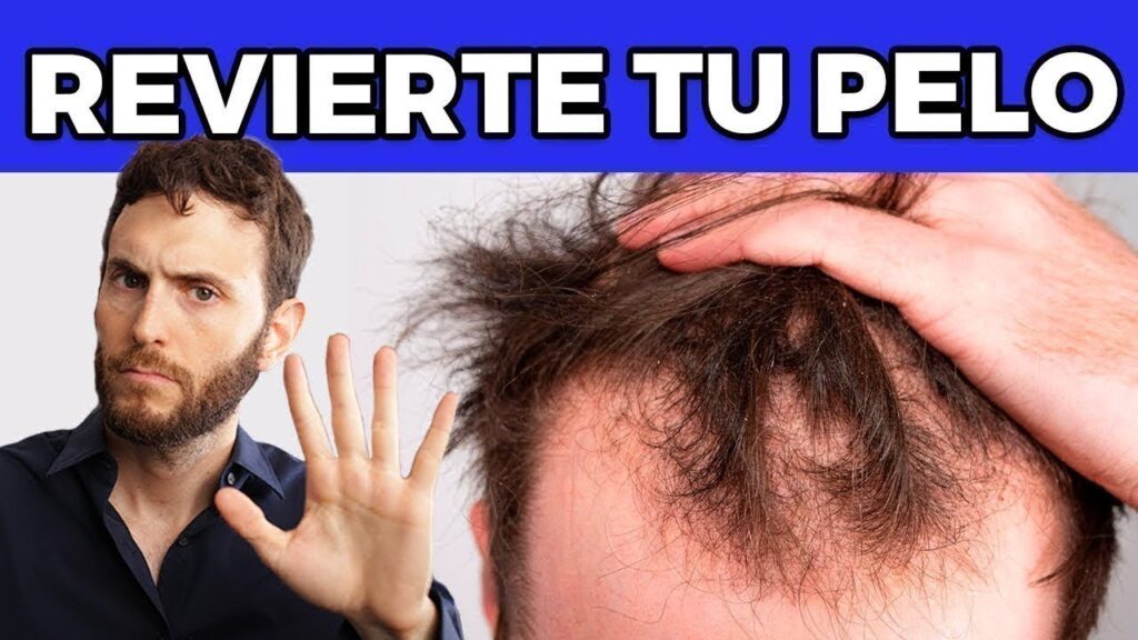 El impacto del estrés en la salud capilar: descubre cómo puede causar picazón en el cuero cabelludo 1 el impacto del estres en la salu 10