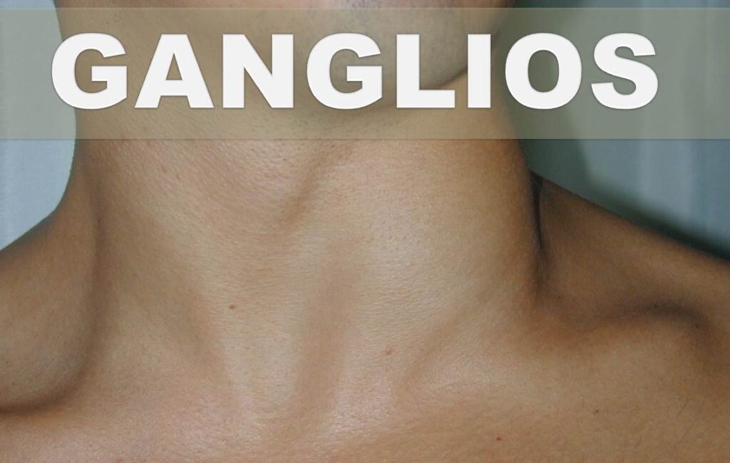 El impacto del estrés en nuestra salud física: el caso de los ganglios inflamados. 1 el impacto del estres en nuestra