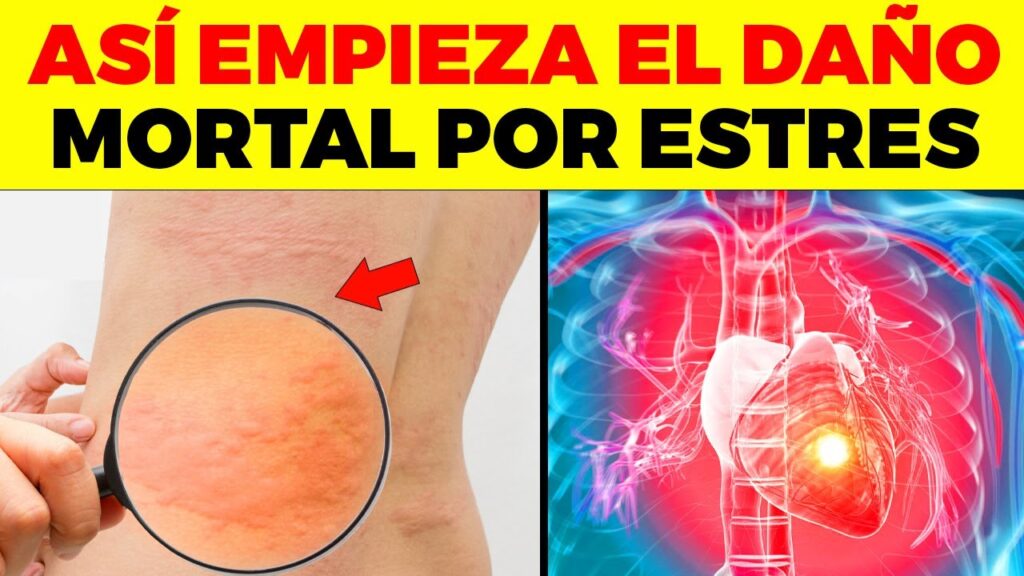 El lado oculto del dolor de cabeza: El impacto psicológico de la meningitis 1 el lado oculto del dolor de cabe