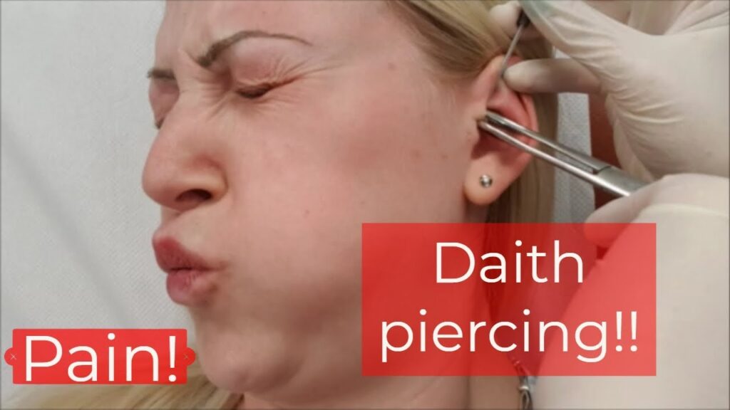 El piercing en el daith y su posible relación con la migraña: ¿mito o realidad? 1 el piercing en el daith y su pos