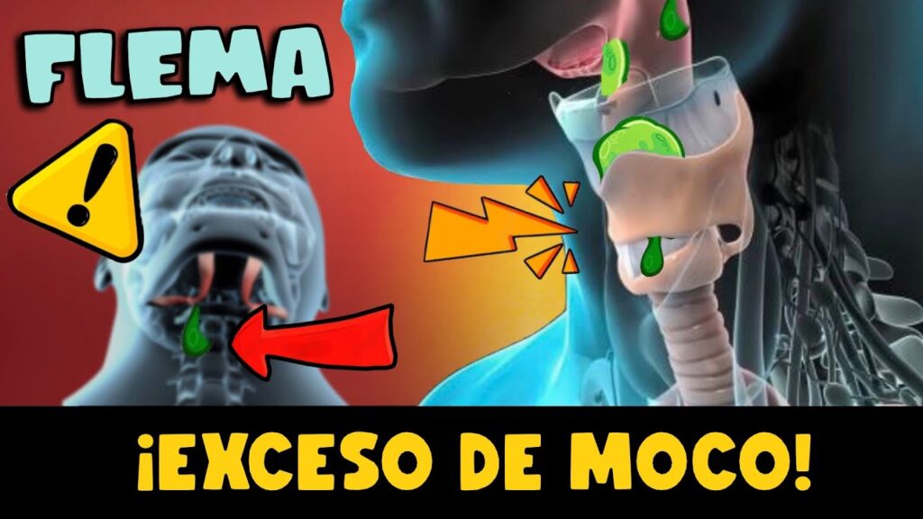 El vínculo entre el ardor en la garganta y la ansiedad: Impacto en la salud mental 1 el vinculo entre el ardor en la