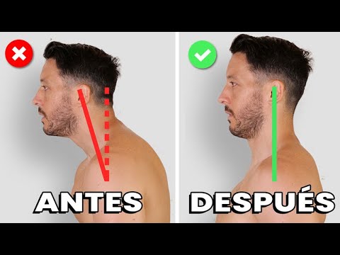 El vínculo entre la postura y la salud mental: el dolor de cabeza como un síntoma de problemas posturales 1 el vinculo entre la postura y la