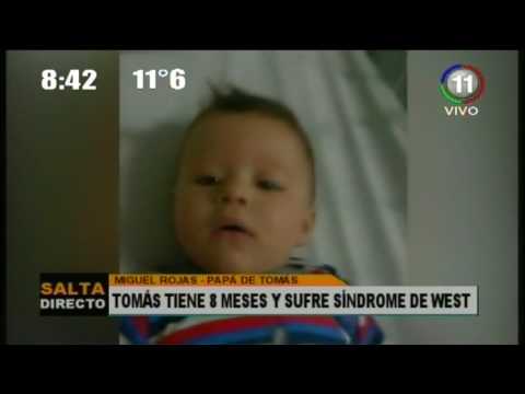Entendiendo los episodios paroxísticos y mioclonias benignas en bebés de 8 meses desde la psicología: Un enfoque integrador 1 entendiendo los episodios paroxi 1
