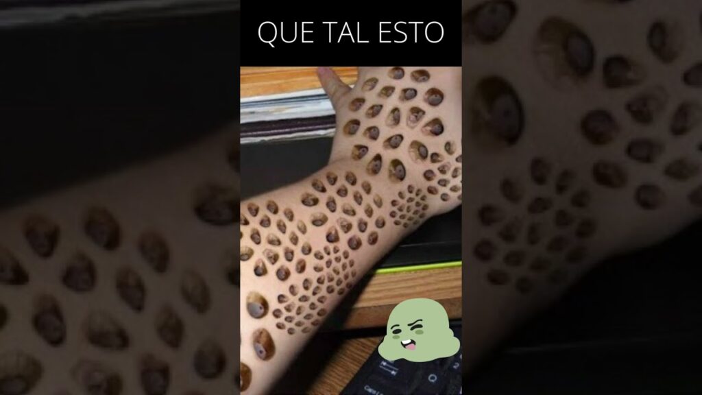 Fobia a los agujeros: Descubre cómo la psicología explica este miedo irracional. 1 fobia a los agujeros descubre co