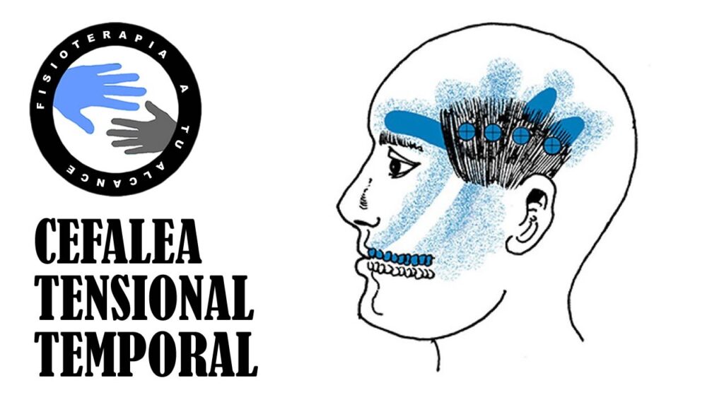Hormigueo en la cabeza: cuando el estrés se manifiesta físicamente en la salud mental 1 hormigueo en la cabeza cuando el