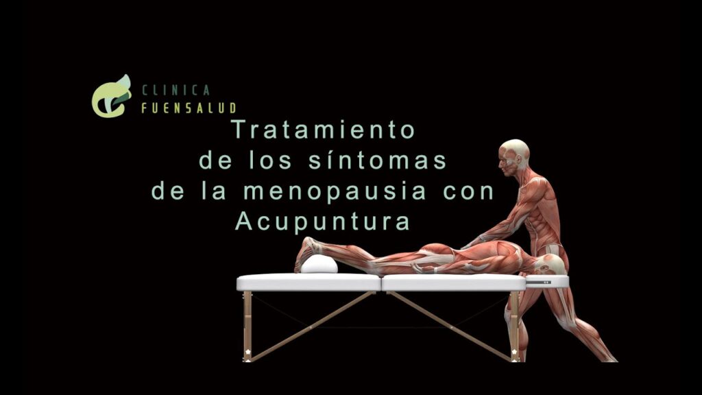 La acupuntura: un enfoque natural para aliviar los síntomas de la menopausia 1 la acupuntura un enfoque natural