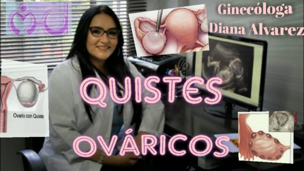 La carga emocional de los quistes ováricos en mujeres después de la menopausia: Un análisis psicológico 1 la carga emocional de los quiste