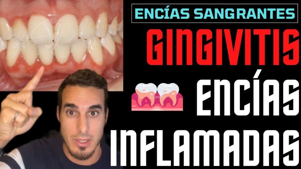 La conexión entre la ansiedad y la inflamación de las encías: impacto en la salud bucal 1 la conexion entre la ansiedad y 157