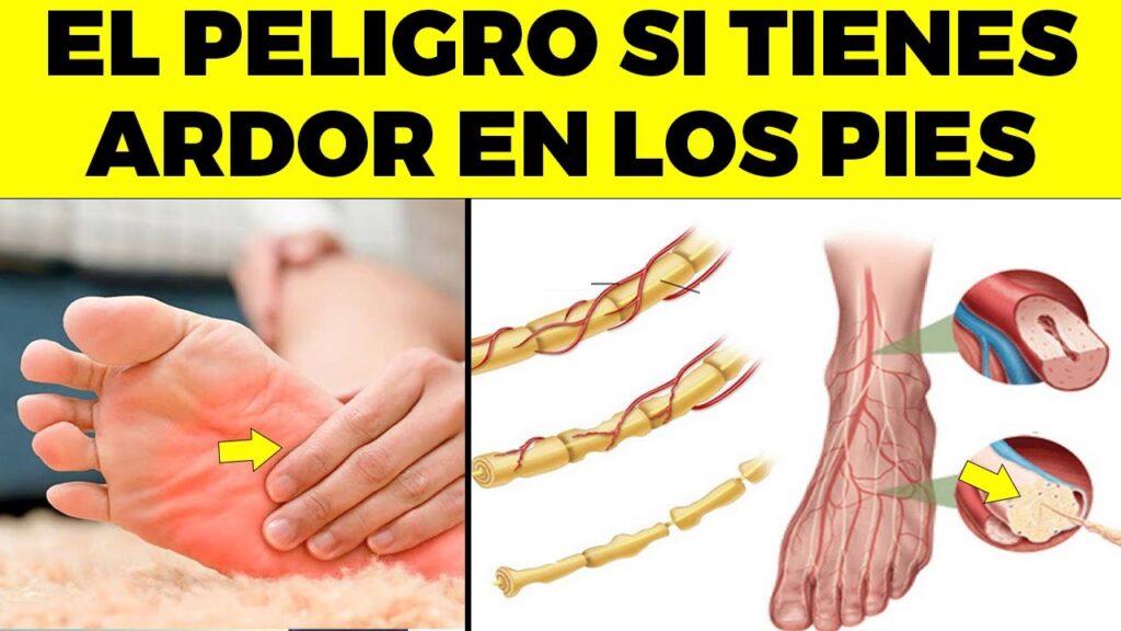 La conexión entre problemas cervicales y dolor de cabeza: una visión desde la psicología 1 la conexion entre problemas cerv