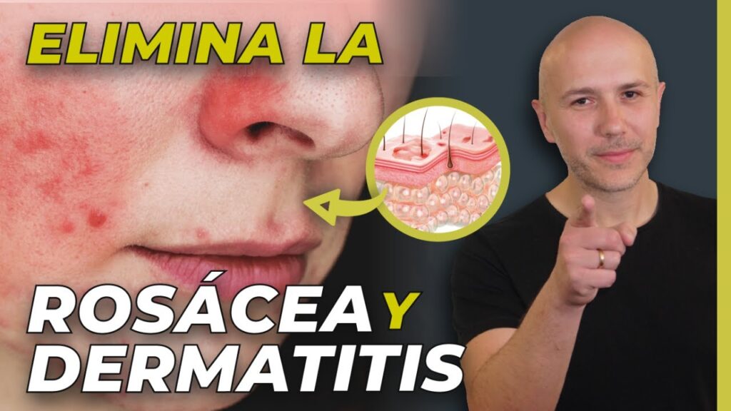 La conexión psicológica entre el estrés y la pérdida de cabello en la cabeza 1 la conexion psicologica entre el 2