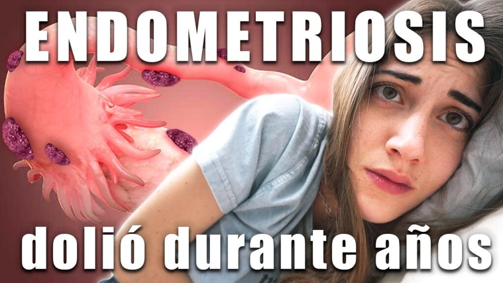 La endometriosis y su impacto psicológico en la menopausia: una mirada desde la perspectiva psicológica 1 la endometriosis y su impacto ps