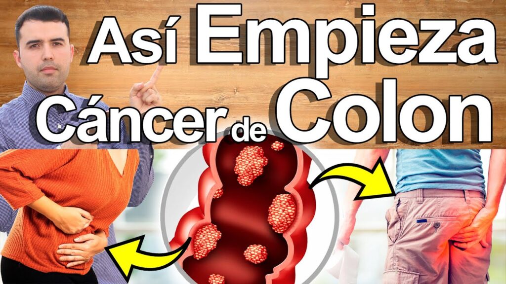 La influencia de la ansiedad en los problemas de gases intestinales: ¿cómo afecta el estrés a nuestro sistema digestivo? 1 la influencia de la ansiedad en 37