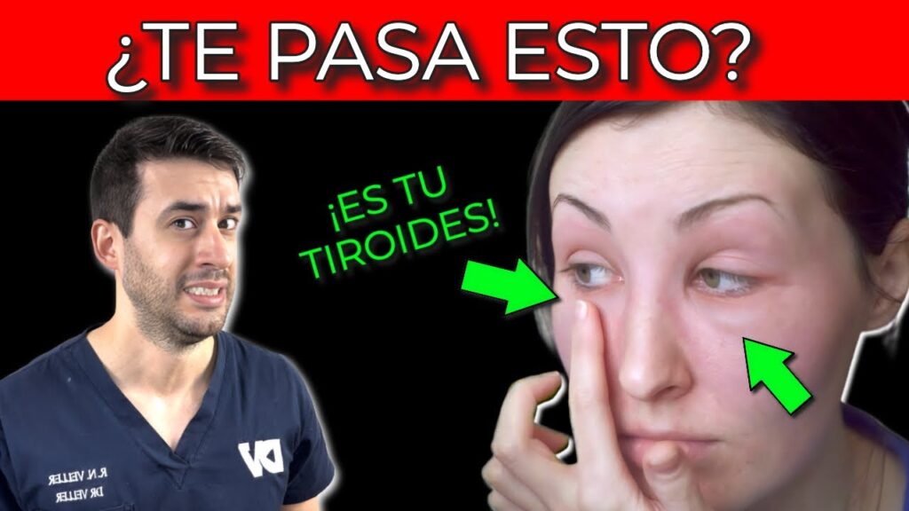 La influencia de la función tiroidea en la ansiedad: Consecuencias para la salud mental 1 la influencia de la funcion tiro