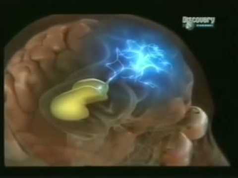 La influencia de la hipoventilación en las mioclonías: un abordaje psicológico 1 la influencia de la hipoventilac