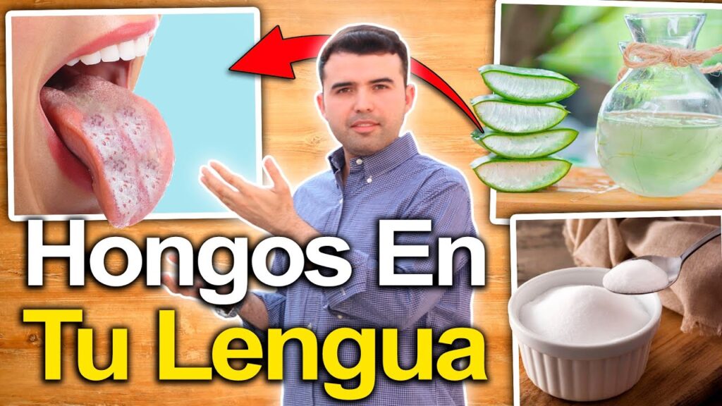 La influencia de la menopausia en la aparición de lengua blanca: Un análisis desde la psicología 1 la influencia de la menopausia e