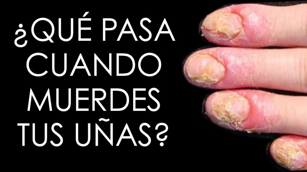 La onicofobia: cuando las uñas largas se convierten en una pesadilla de miedo y ansiedad 1 la onicofobia cuando las unas la