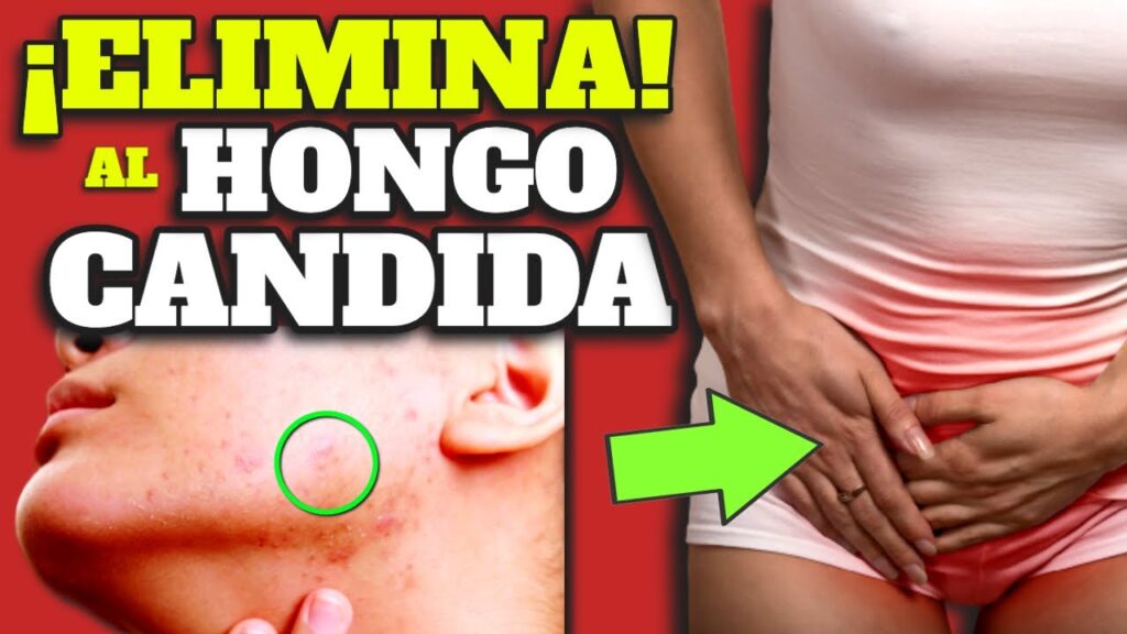 Lesiones en la lengua: ¿Un indicador del impacto del estrés en nuestra salud oral? 1 lesiones en la lengua un indicad