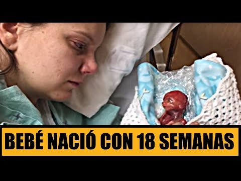 Los reflejos involuntarios en el recién nacido: su importancia en el desarrollo y cómo afectan 1 los reflejos involuntarios en el