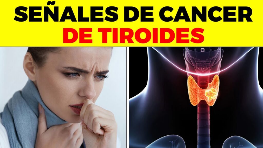 Menopausia prematura: Cómo identificar los signos tempranos y cuidar la salud femenina 1 menopausia prematura como identi
