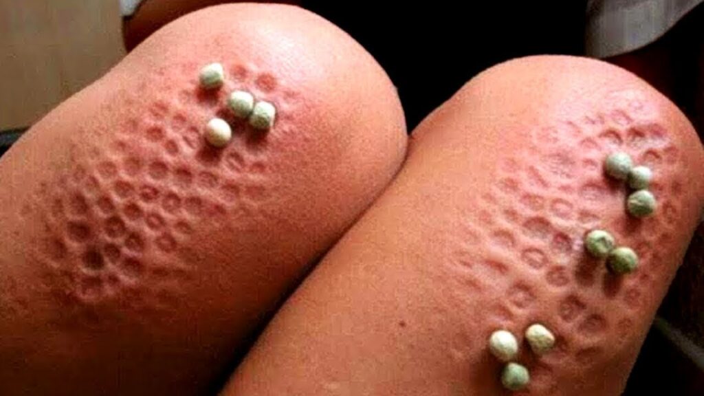 Venciendo el miedo a los patrones de agujeros: Estrategias de psicología para superar la trypophobia 1 venciendo el miedo a los patrone